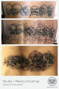 A row of unwanted skulls is transformed into a tattoo of peony flowers by Naomi Hoang.