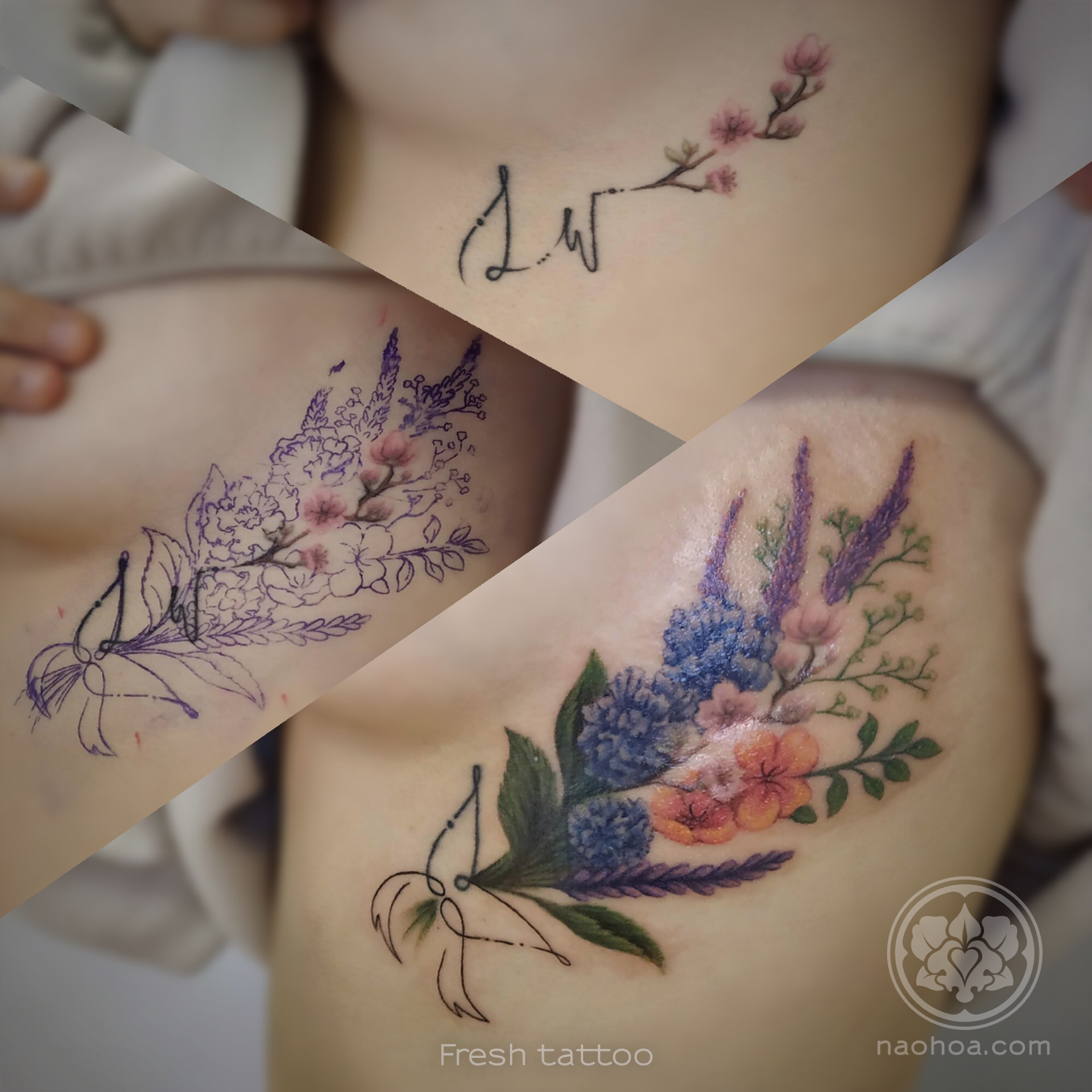 What You Need to Know about Scar Cover-Up Tattoos