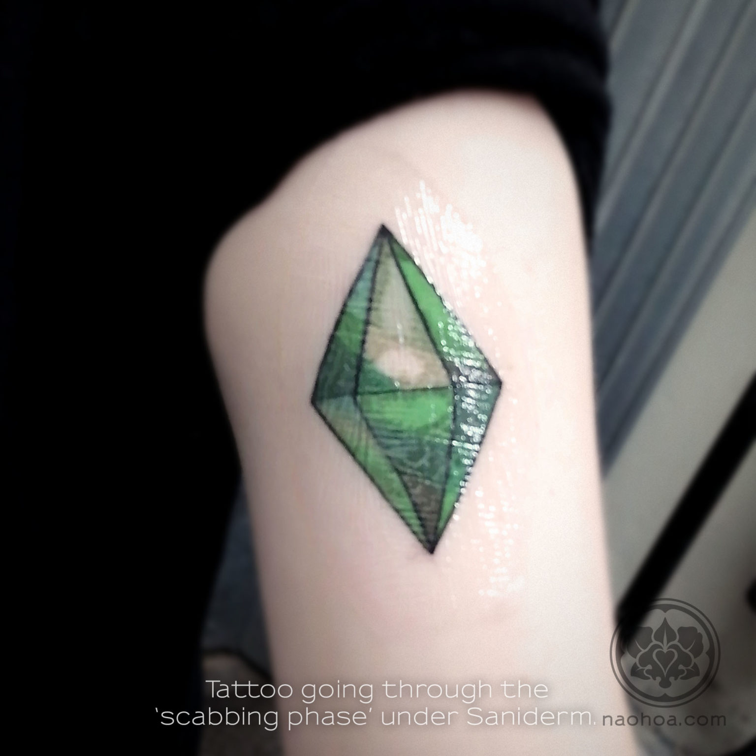 saniderm naohoa scabbing cracking appears