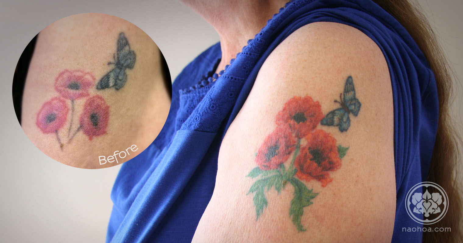 An old tattoo of three poppies given a new lease of life by Naomi Hoang, NAOHOA Luxury Bespoke Tattoos, Cardiff, Wales (UK).