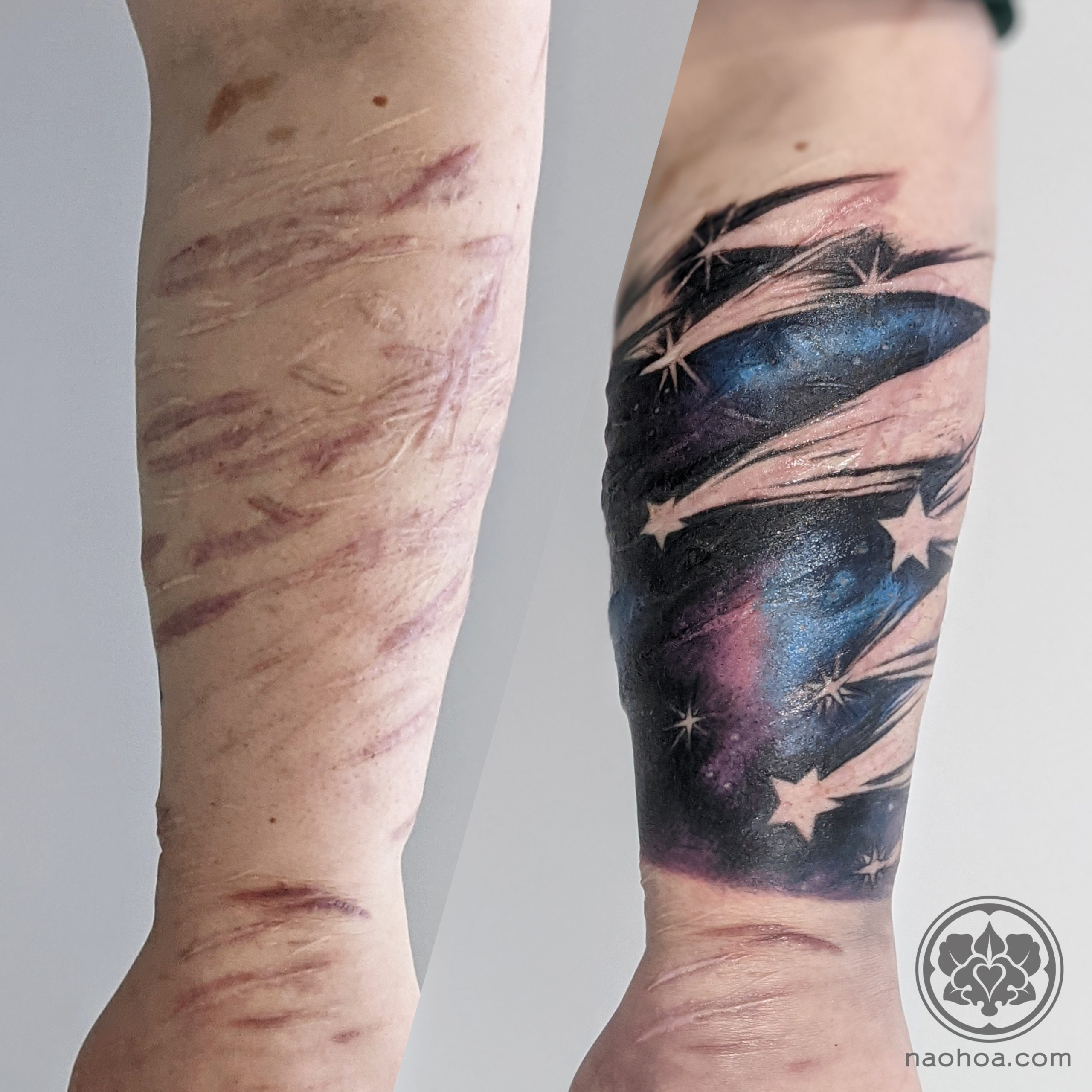Tattoos over sh scars